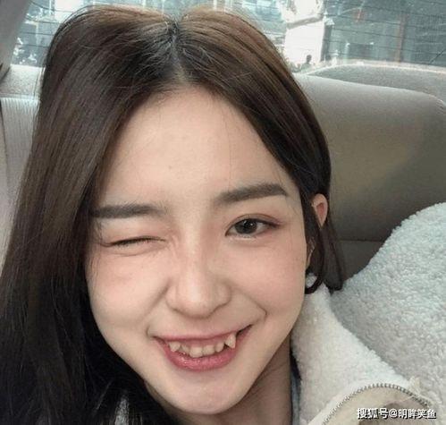 虎牙吃瓜事件结果,真相大白，各方势力尘埃落定